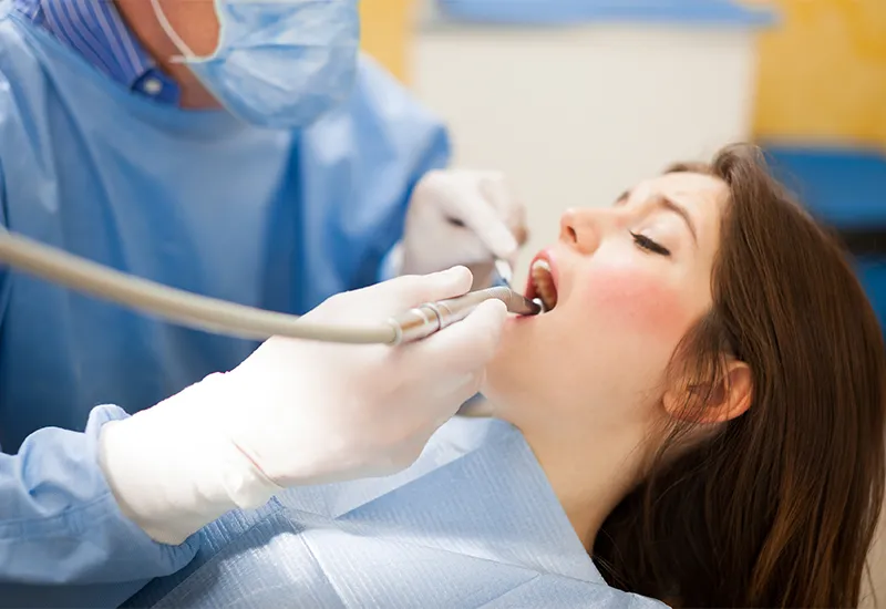 dental fillings