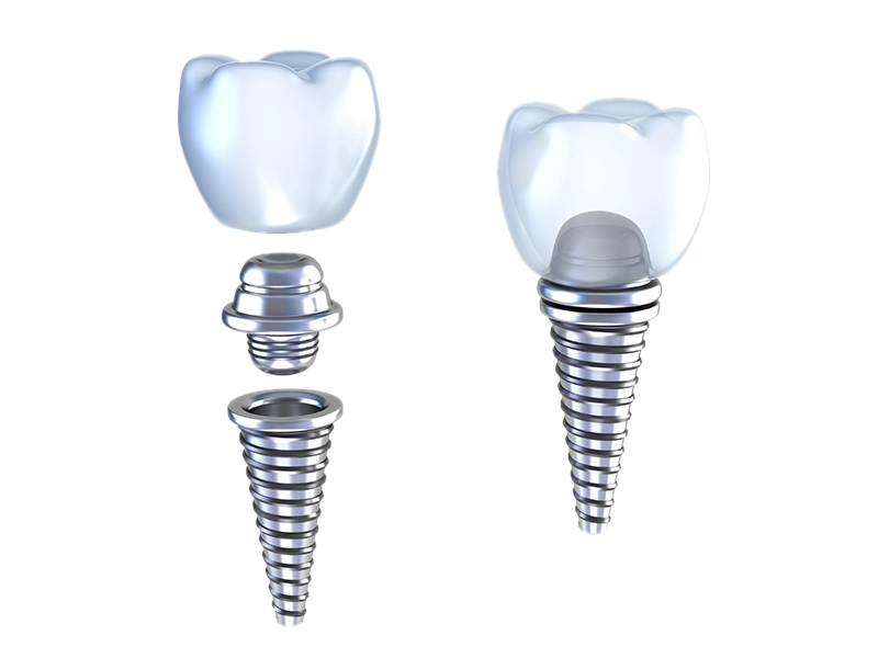 implant cosmetic case study