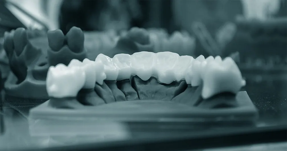 3D Printer Lower jaw from a photopolymer