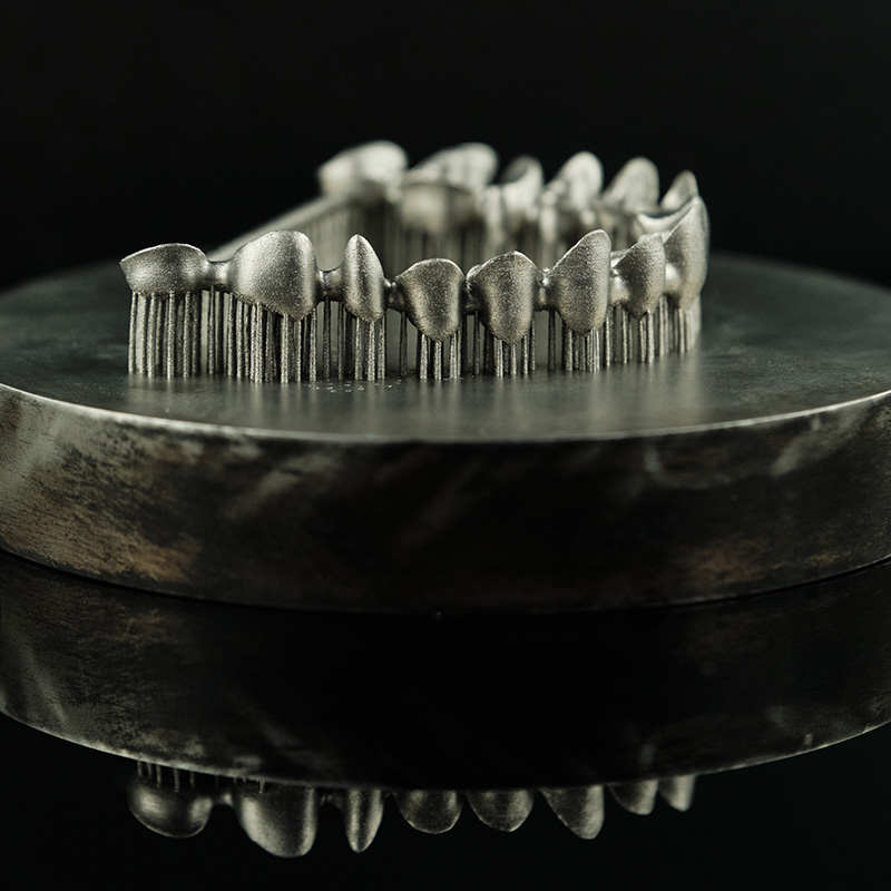 3D-printed dental crown