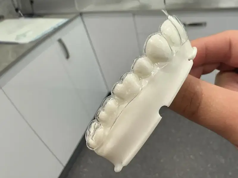 3D-Printed Clear Aligners