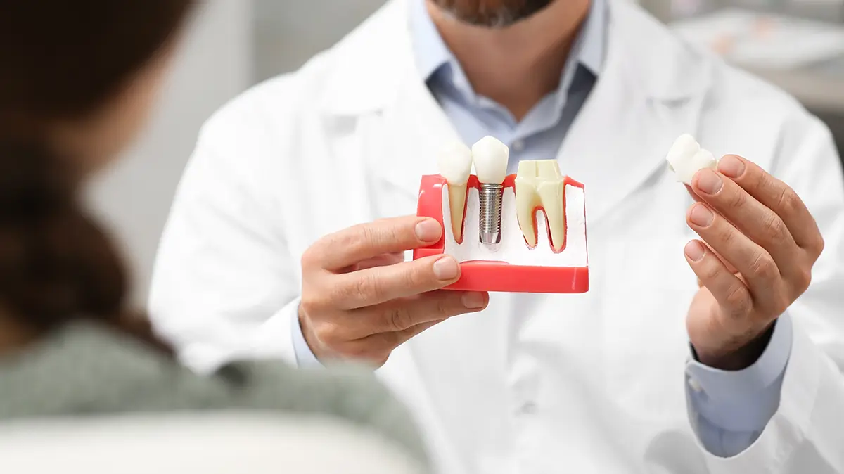 Dental implants