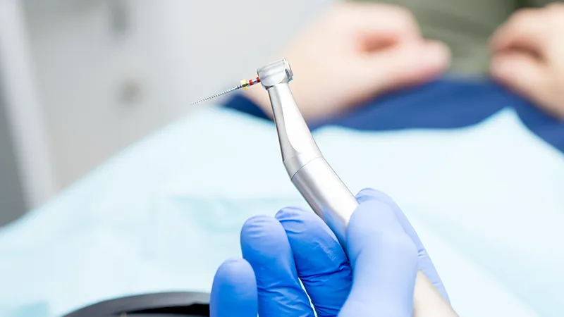 Root canal Root canal
