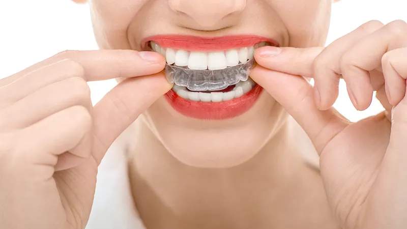 Orthodontic Orthodontic
