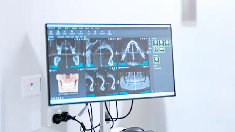 CBCT scan CBCT scan
