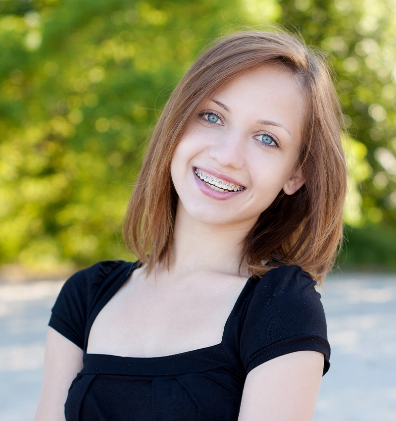 teenager’s peg lateral incisor