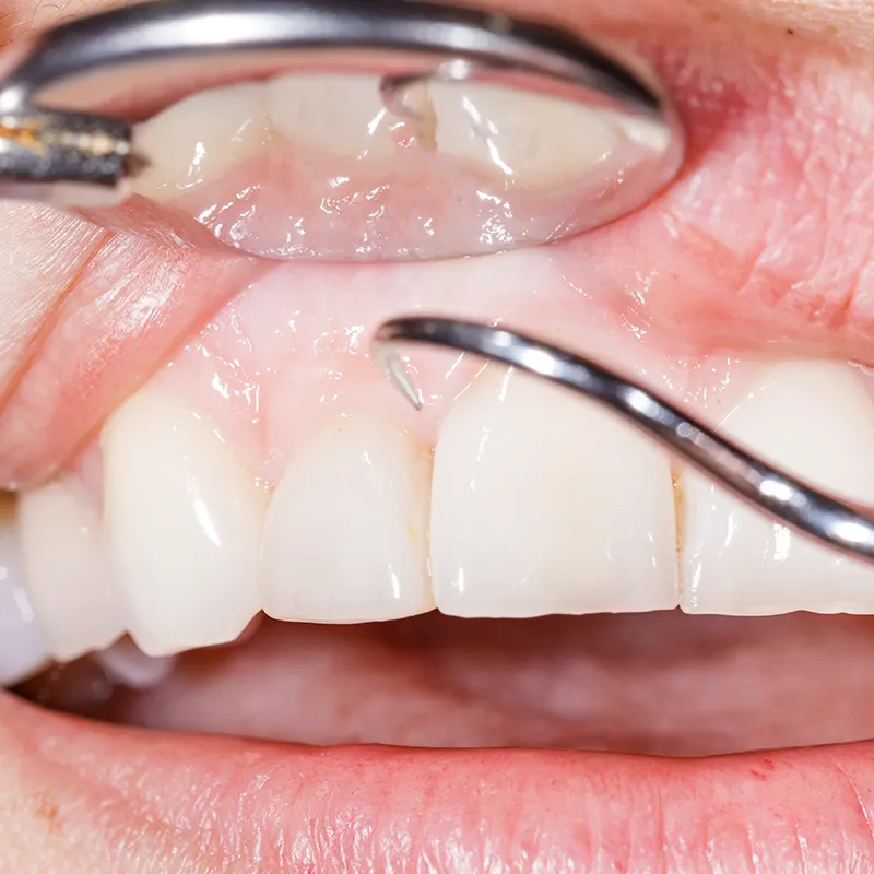 healthy gum healthy gum