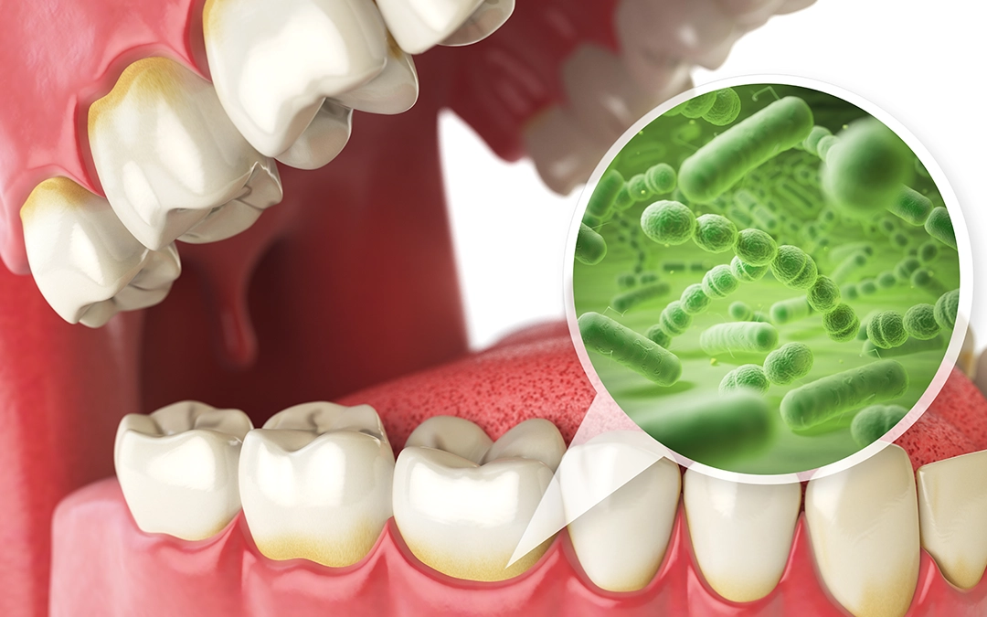 The hidden world of oral bacteria The hidden world of oral bacteria