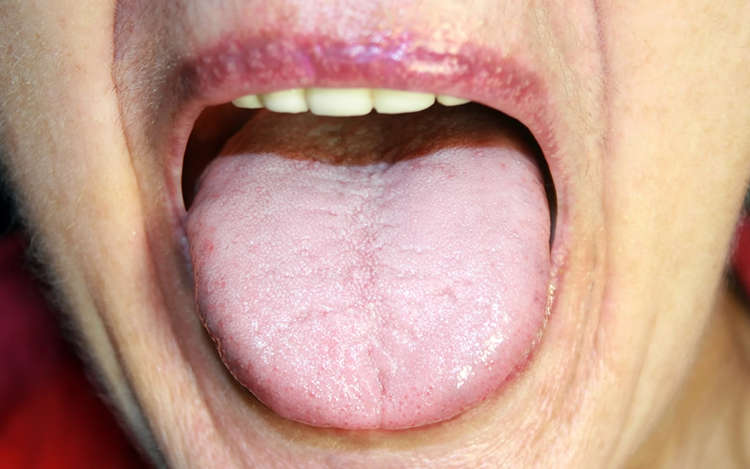 The hidden world of oral bacteria The hidden world of oral bacteria