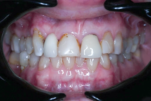 Dental Concerns Dental Concerns