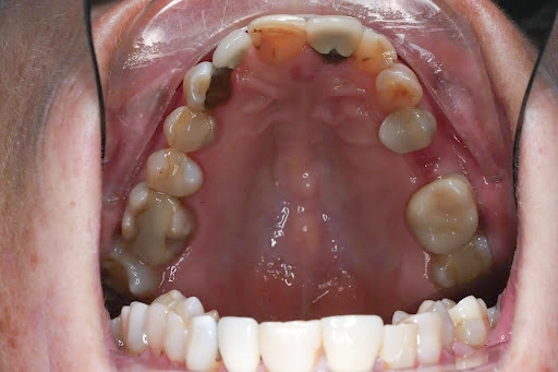 Dental Concerns Dental Concerns