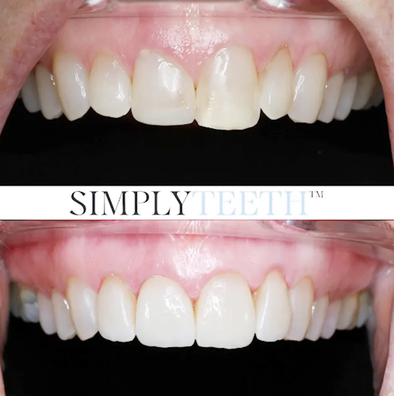 Before and after process Before and after process