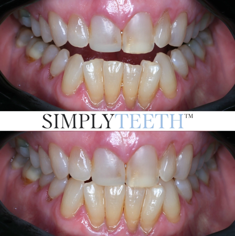 Patients Concern Patients Concern