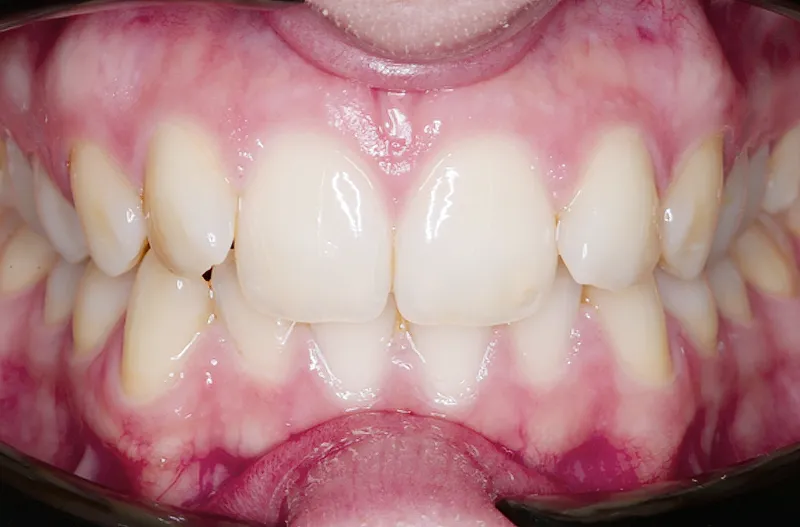 Patient presentation Patient presentation