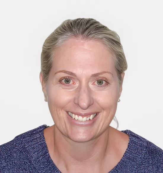 Before Invisalign and Ceramic Restoration