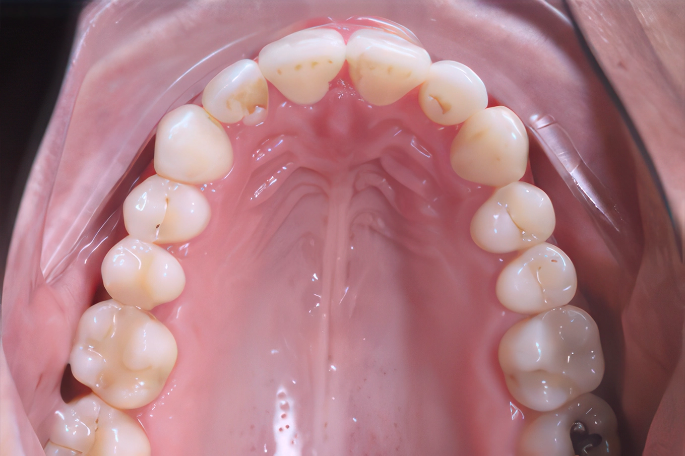 Smile comparison: Before vs after