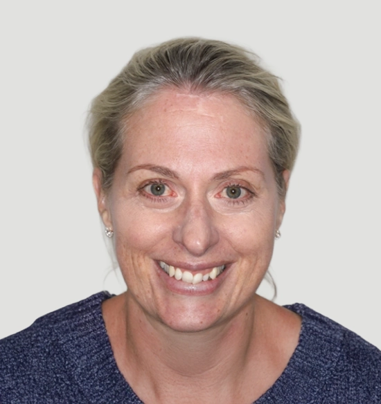 Before Invisalign and Ceramic Restoration