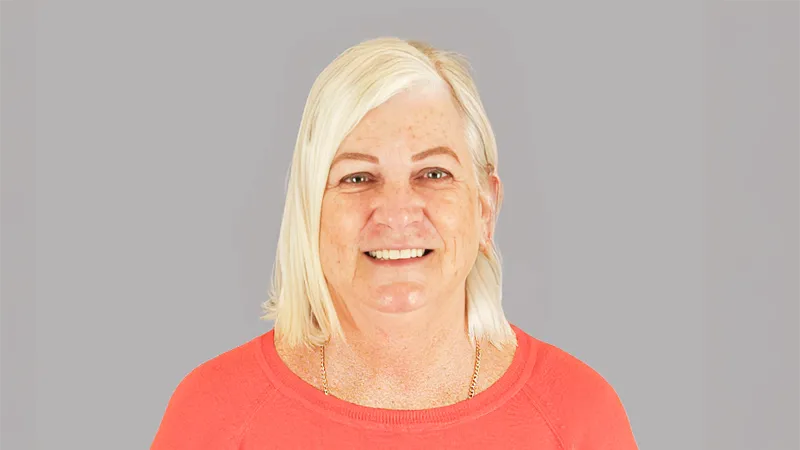 Full Upper Anterior Restoration