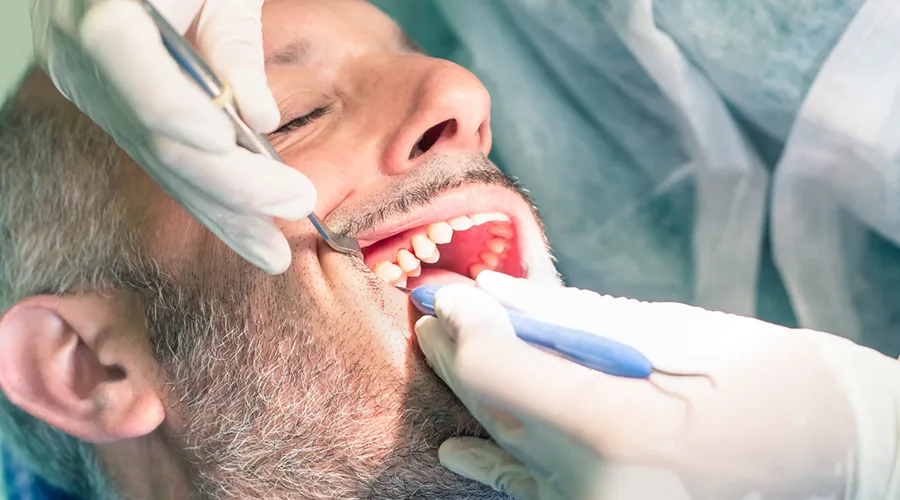 Dental Trauma Dental Trauma