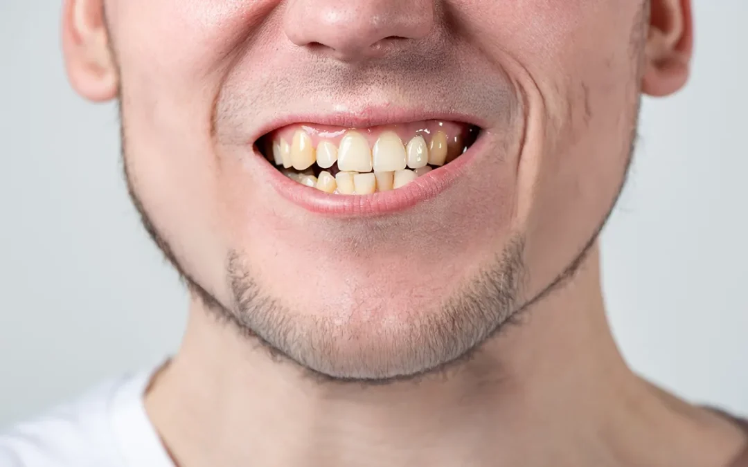 Designing natural symmetry for an uneven smile