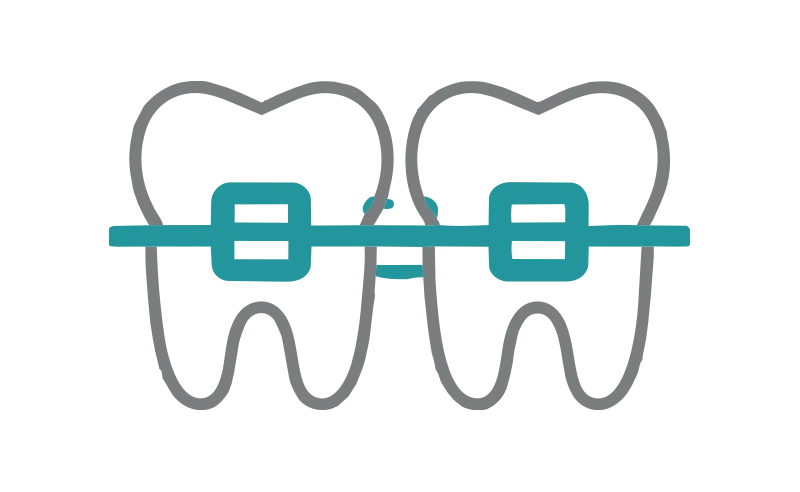 Orthodontic planning