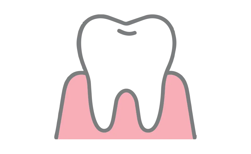 Advanced gum disease